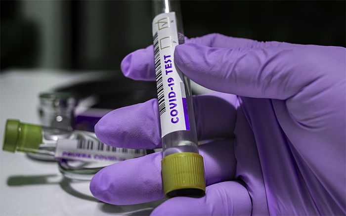 Covid: nelle acque reflue piemontesi domina ancora la variante Omicron BA.2