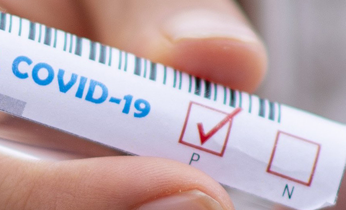 Covid: in Piemonte ancora 3mila positivi al giorno, i dati per provincia 