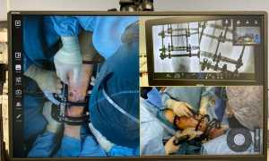 asl vercelli operazione streaming