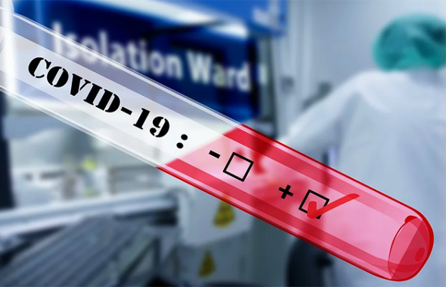 covid coronavirus test termometro