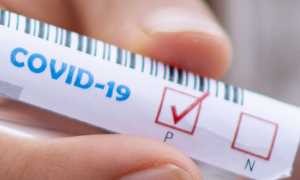 covid positivo test test tube 5065426