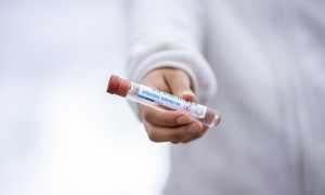 test tube 5065426 640